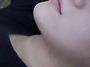 이중턱 지흡 + 턱끝 근육묶..
