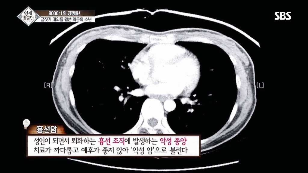 영재발굴단