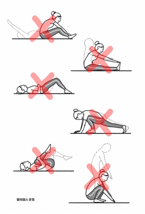서울대병원 정선근 교수가 말하는 허리 디스크에 좋은 운동과 안 좋은 운동