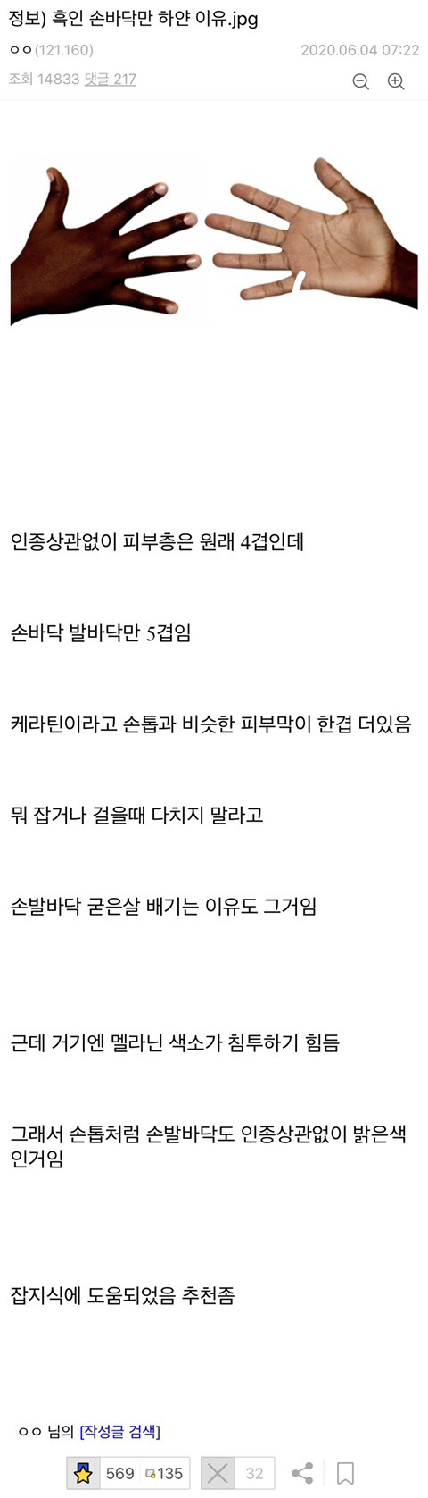 인종에 상관없이 손바닥이 하얀 이유