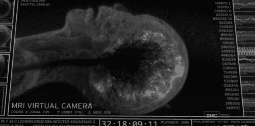 인간이 죽는 순간 뇌 MRI