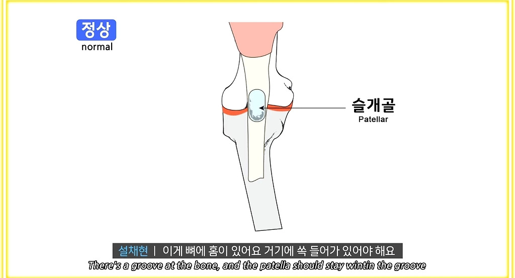 한국에만 슬개골 탈구 강아지가 많은 이유 - ○○