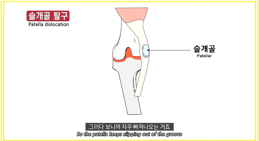 한국에만 슬개골 탈구 강아지가 많은 이유 - ○○