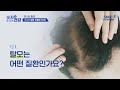 첨부된 유튜브 동영상