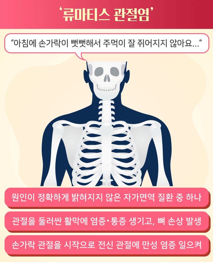 류마티스 관절염_02.gif