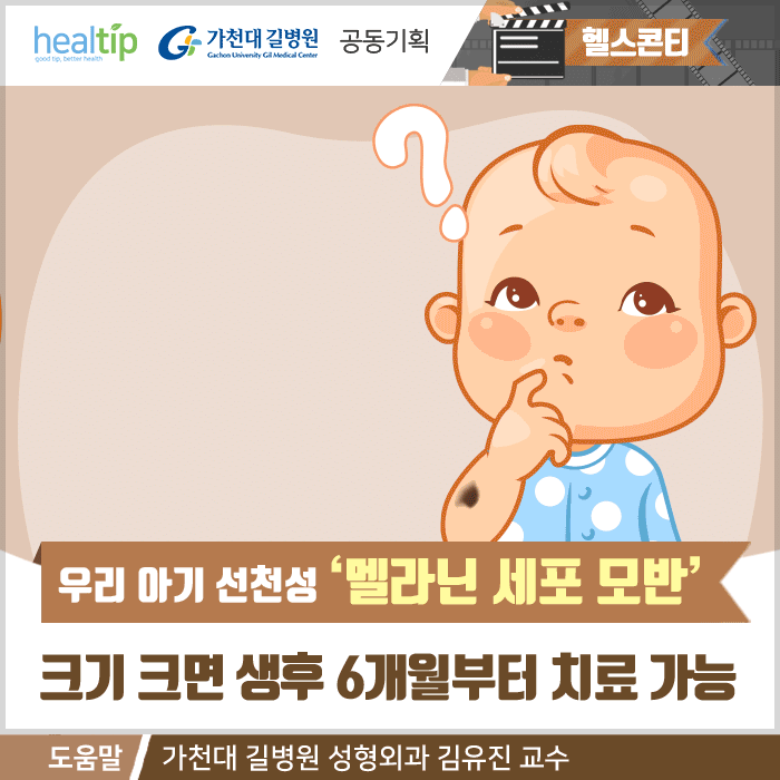 선천성 모반_01m_힐팁.gif