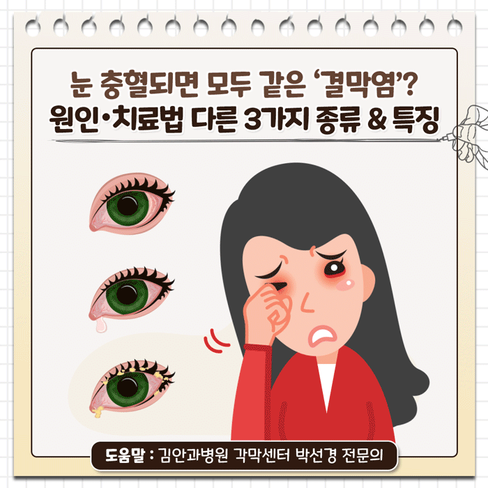 결막염_01.gif