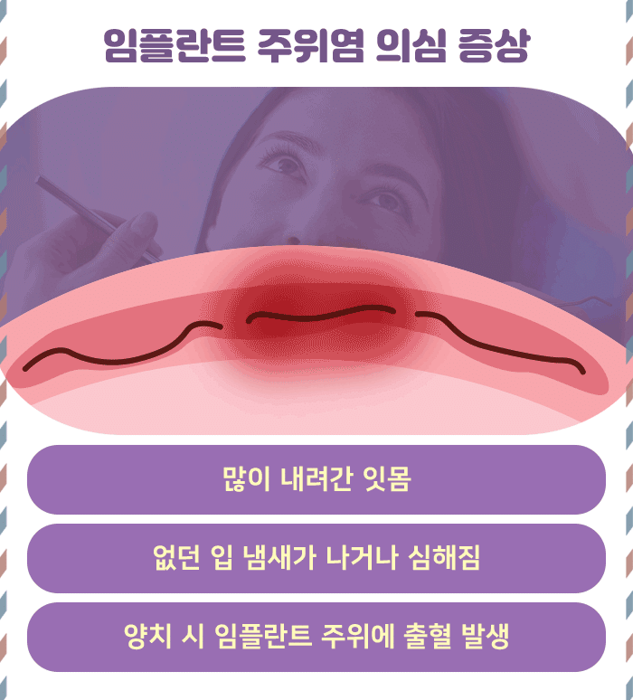 임플란트 주위염_4.gif