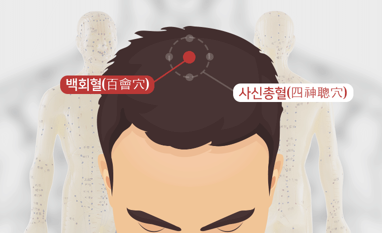4_백회혈,사신총혈.gif
