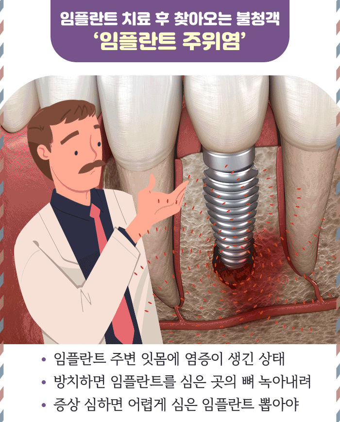 임플란트 주위염_2.gif