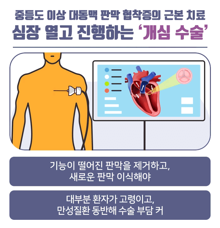 대동맥 판막 협착증_07.gif