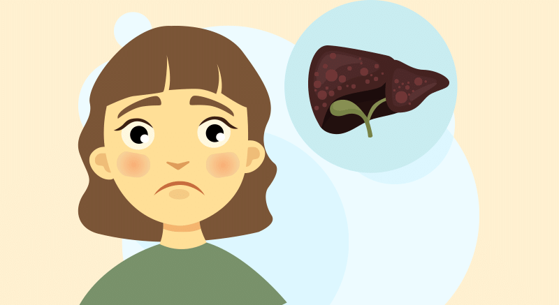 4.※ 원발성 담즙성 간경변증 주요 증상.gif