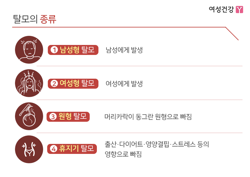 6.※탈모의 종류.gif