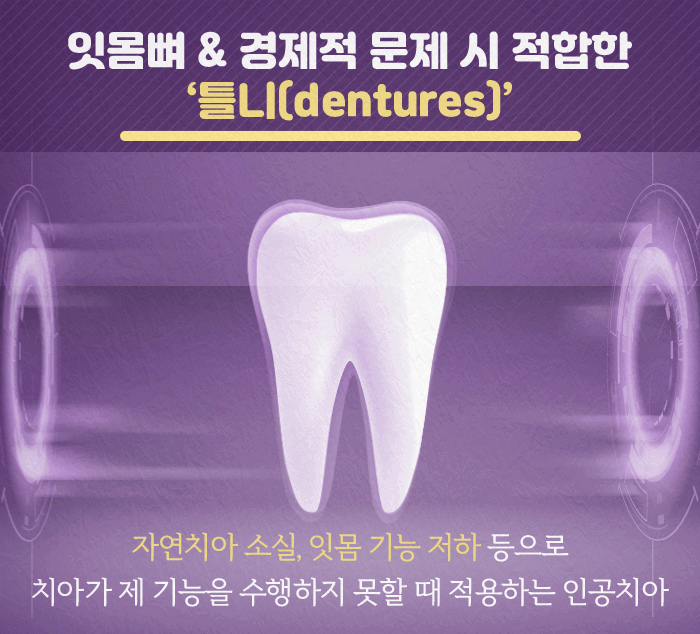 틀니_3.gif