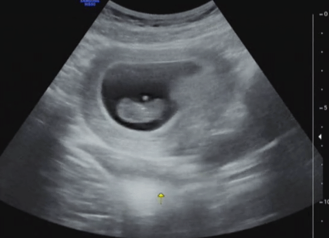 SmartSelect_20181015-141707_Video Player.gif