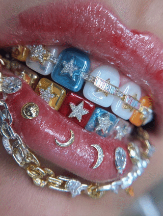 v1zzo__a_close-up_of_a_girls_mouth_with_Grillz_on_the_teeth_t_1a56d0fe-4924-47ab-8085-b9c015b9da6b_0.gif