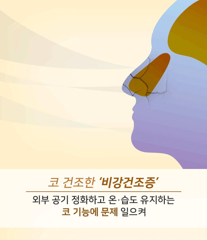 콧속에 가뭄이 들었다