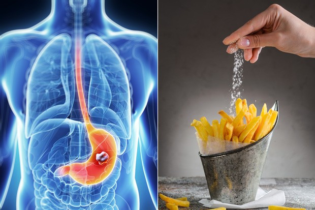 - 소금과 위암.jpg