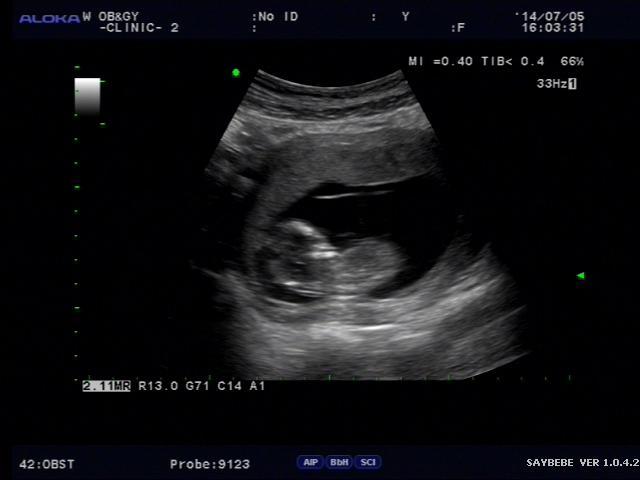 2014-07-12 12.12.52.jpg