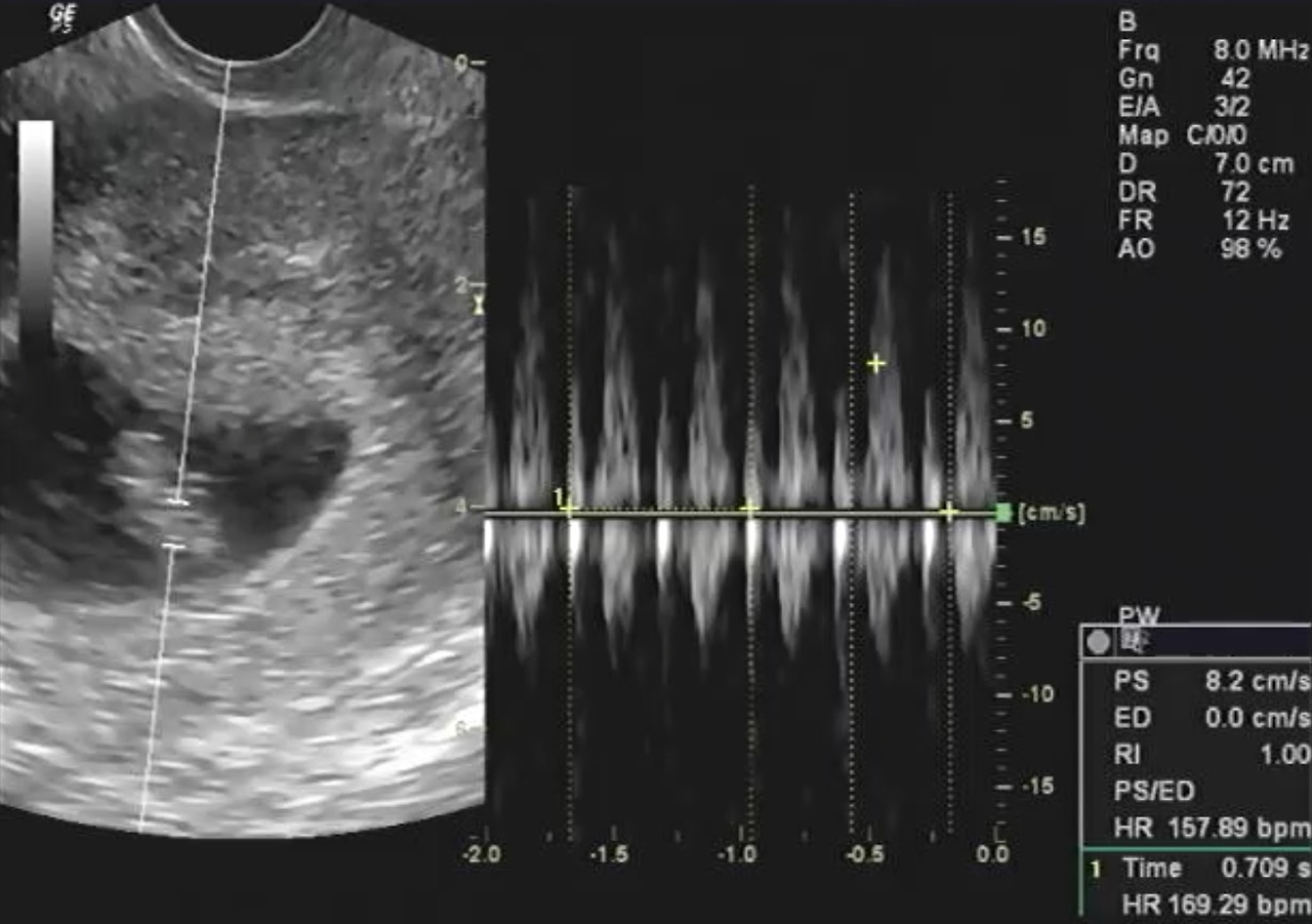 Screenshot_20190114-141624_Video Player.jpg