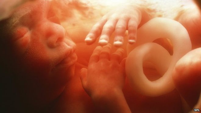 _82945715_p6800471-five_month_old_foetus-spl.jpg