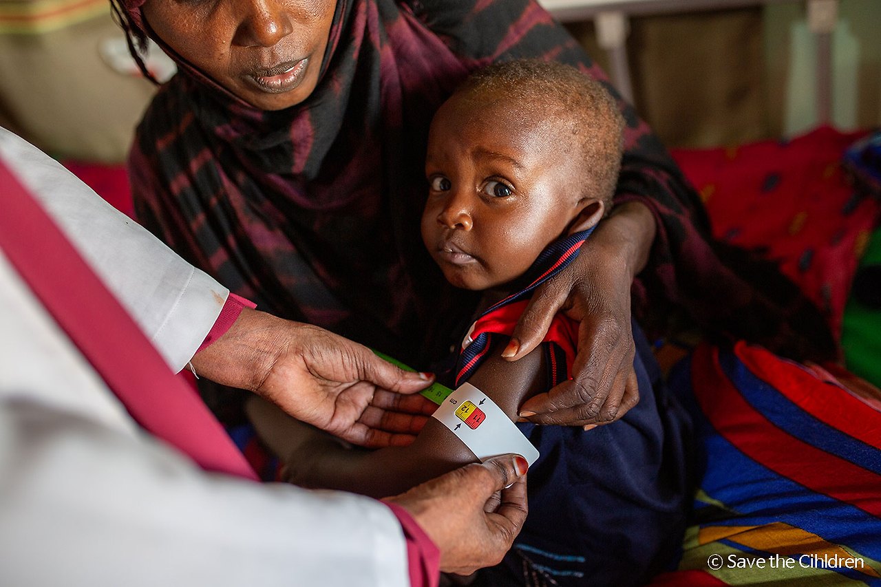 250314 [첨부사진] 세이브더칠드런 의료진이 압디(17개월, 가명)의 영양실조 증상을 진찰하기 위해 뮤악밴드를 사용하고 있다.jpg