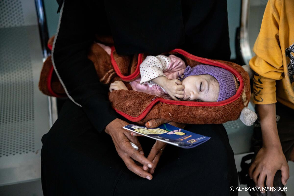 250312 [첨부사진] 세이브더칠드런 예멘의 한 센터에서 영양실조 치료를 받고 있는 렘(가명, 8개월).jpg