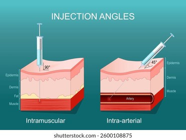 injection-angles-cross-section-human-260nw-2600108875.jpg