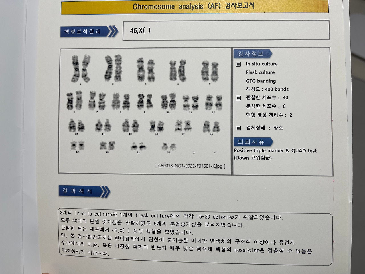 다운증후군 검사 결과가 나왔다.