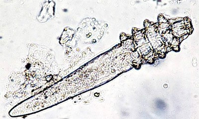 demodex(1).jpg