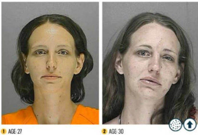 FireShot Capture 549 - 비포 앤 애프터 약물 (Meth) _ 메담 페타 민의 공포 인포 그래픽 - www.rehabs.com.jpg