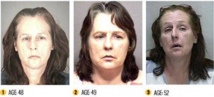 FireShot Capture 546 - 비포 앤 애프터 약물 (Meth) _ 메담 페타 민의 공포 인포 그래픽 - www.rehabs.com.jpg