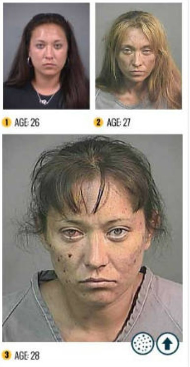 FireShot Capture 543 - 비포 앤 애프터 약물 (Meth) _ 메담 페타 민의 공포 인포 그래픽 - www.rehabs.com.jpg