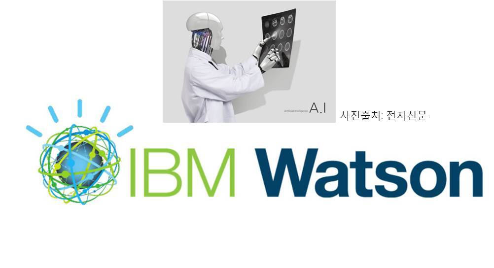 왓슨.jpg