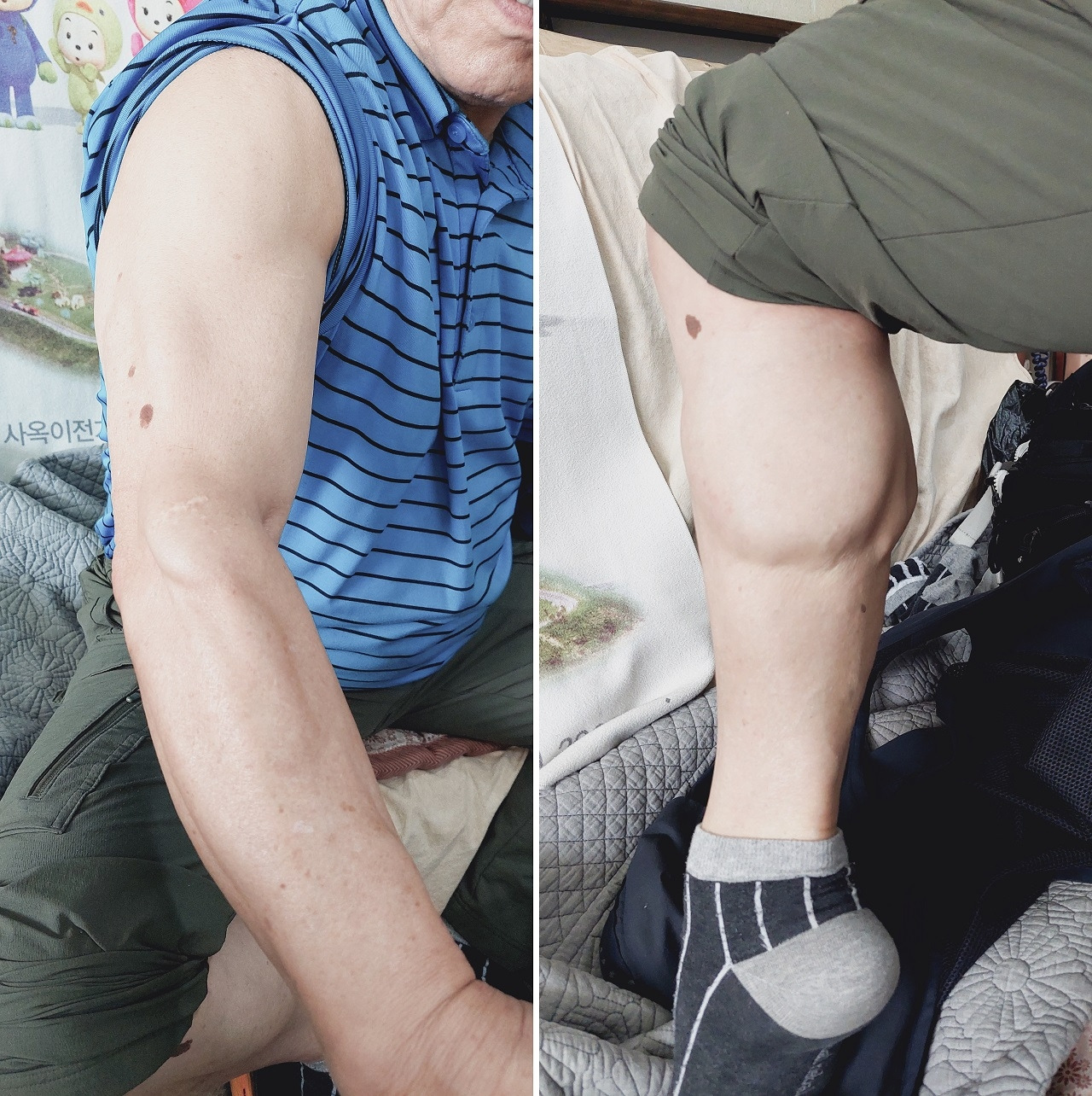 20250526_112146 팔 다리 근육.jpg