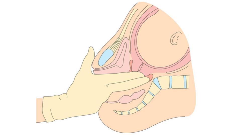 pelvic-exam.jpg