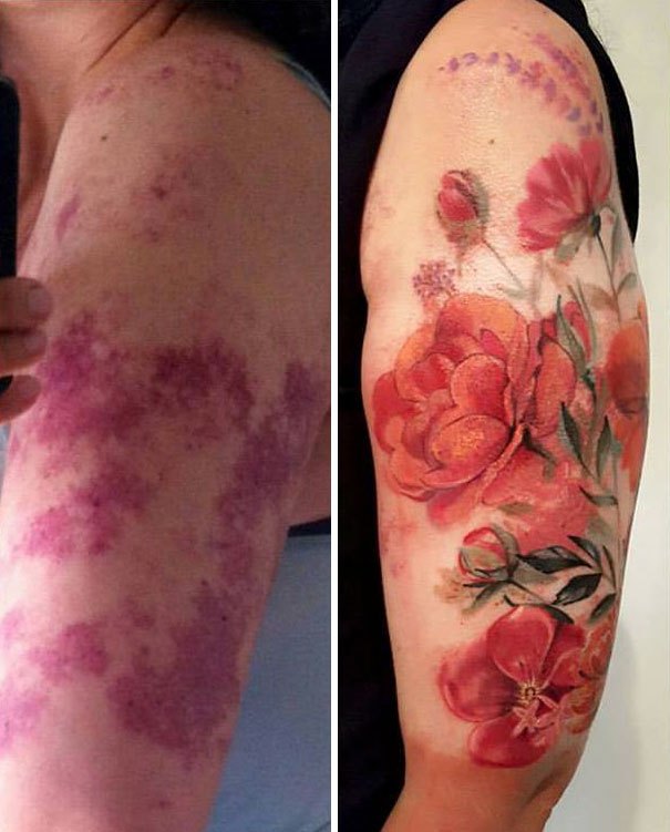 creative-tattoos-birthmark-cover-ups-8.jpg