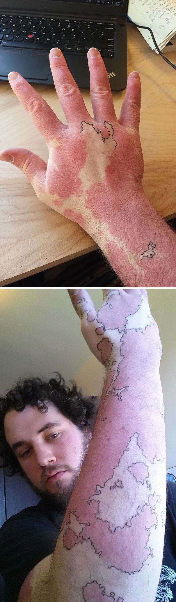 creative-tattoos-birthmark-cover-ups-5.jpg