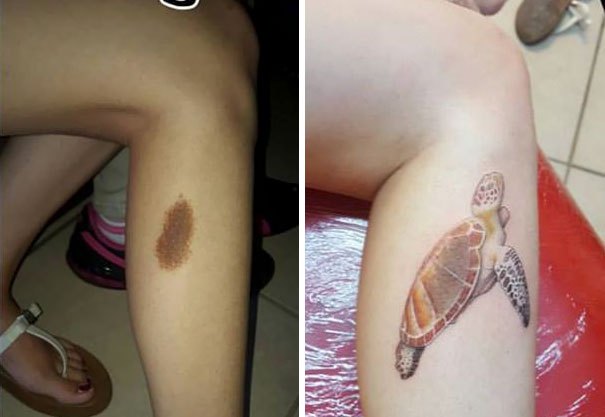 creative-tattoos-birthmark-cover-ups-10.jpg