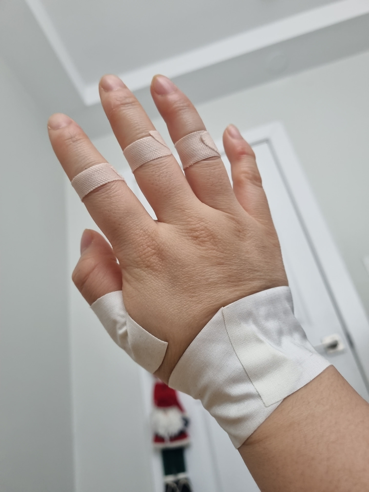 붓고 관절마다 아픈 손.jpg