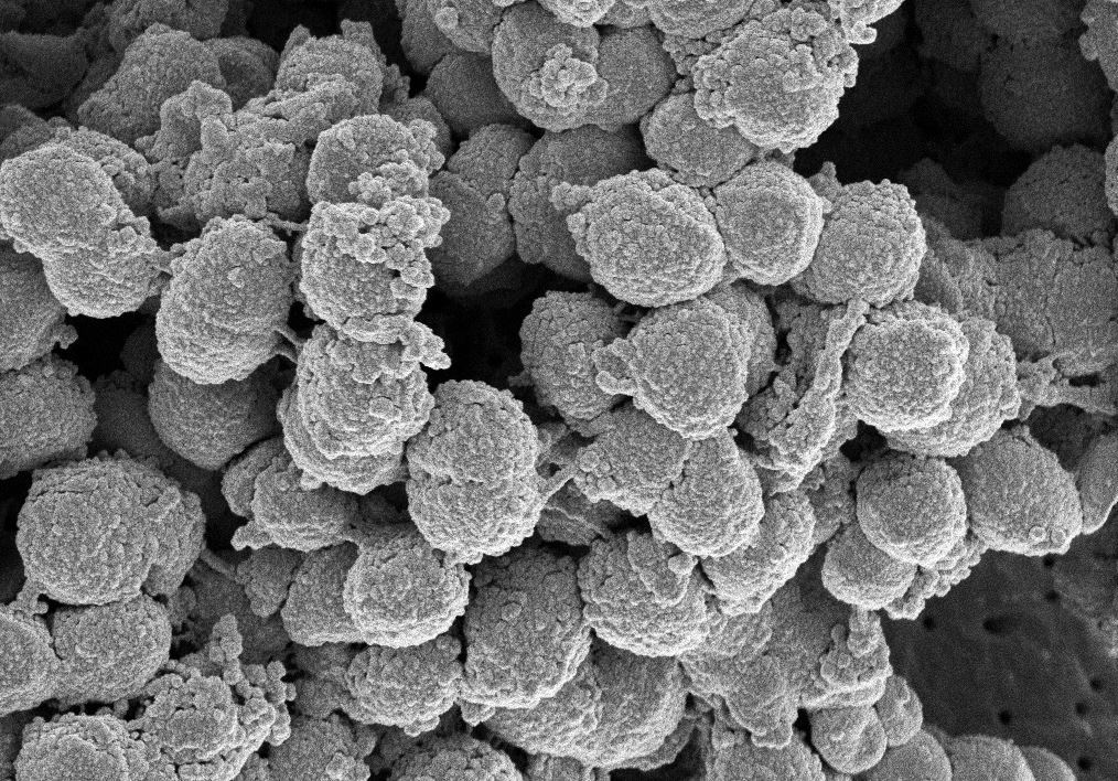 그림4-Methanomethylovorans upoensis1-우포늪습지 고세균 01.jpg
