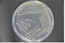 그림3-해당화 내생균류 배양체.jpg