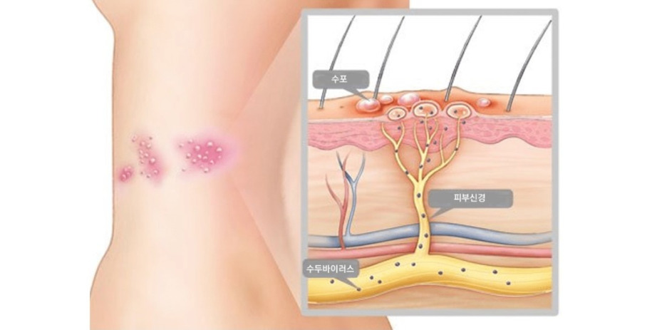 라이브 바카라