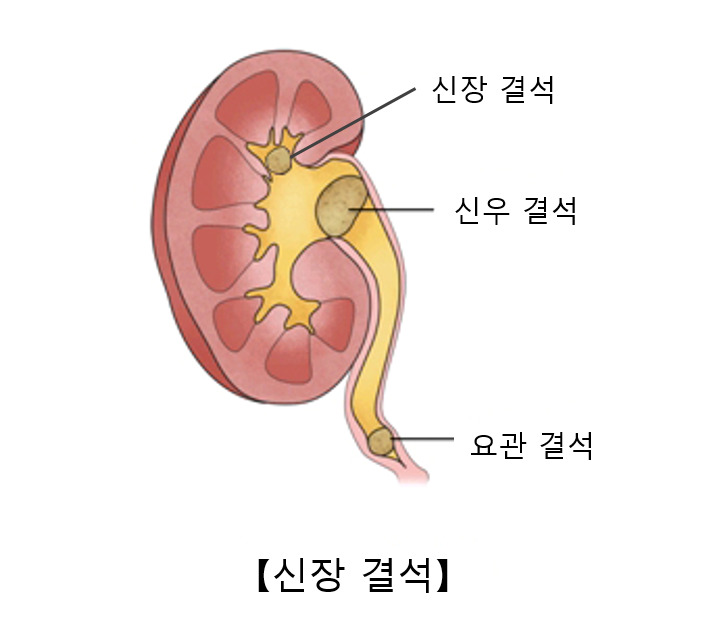 라이브 바카라