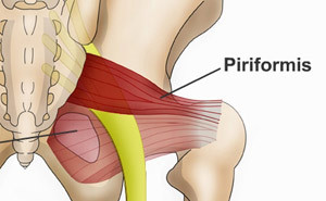 Piriformis-syndrome (1).jpg