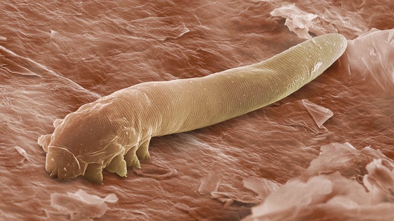 demodex_wide-3ae0bab529fbd9dbd3b98ff591fdd0542a271c65-s800-c85.jpg