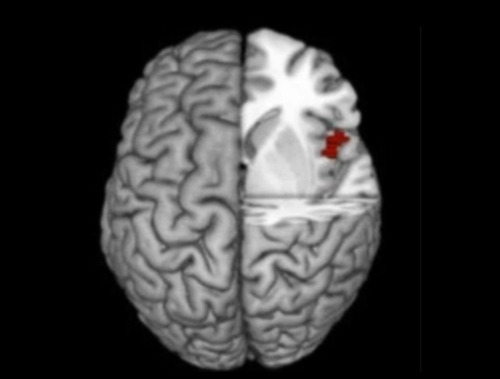 자기 희생적 행위와 전두엽.jpg