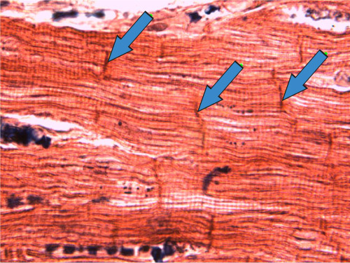 주기화 원리_운동 후 손상된 근육.jpg