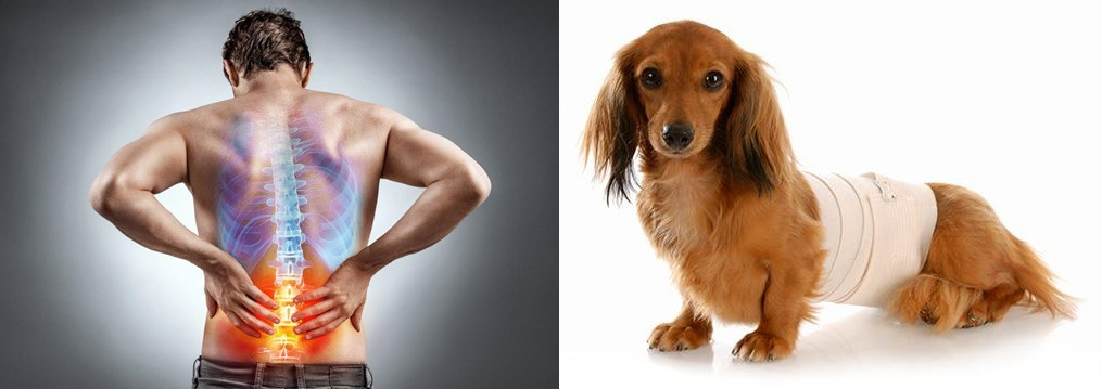 허리디스크_허리통증_back pain_4.jpg