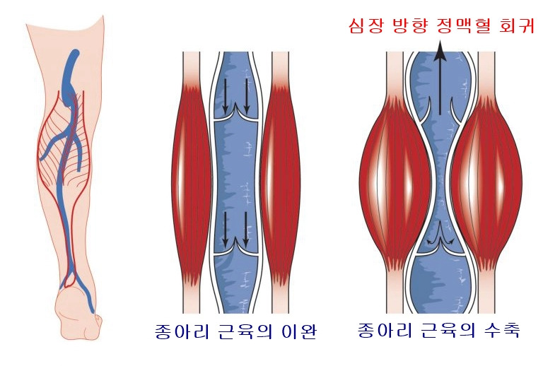 제2의 심장_종아리_근육펌프_정맥회귀.jpg